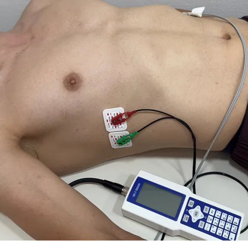 胸部に電極を装着し、計測デバイスに接続している様子。